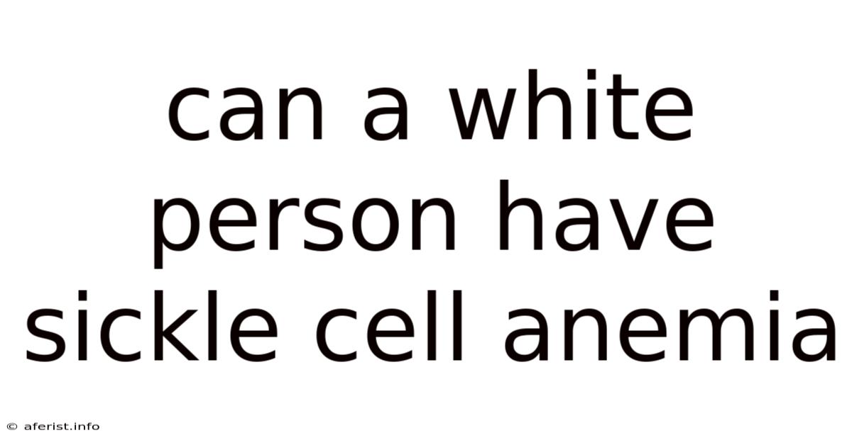 Can A White Person Have Sickle Cell Anemia