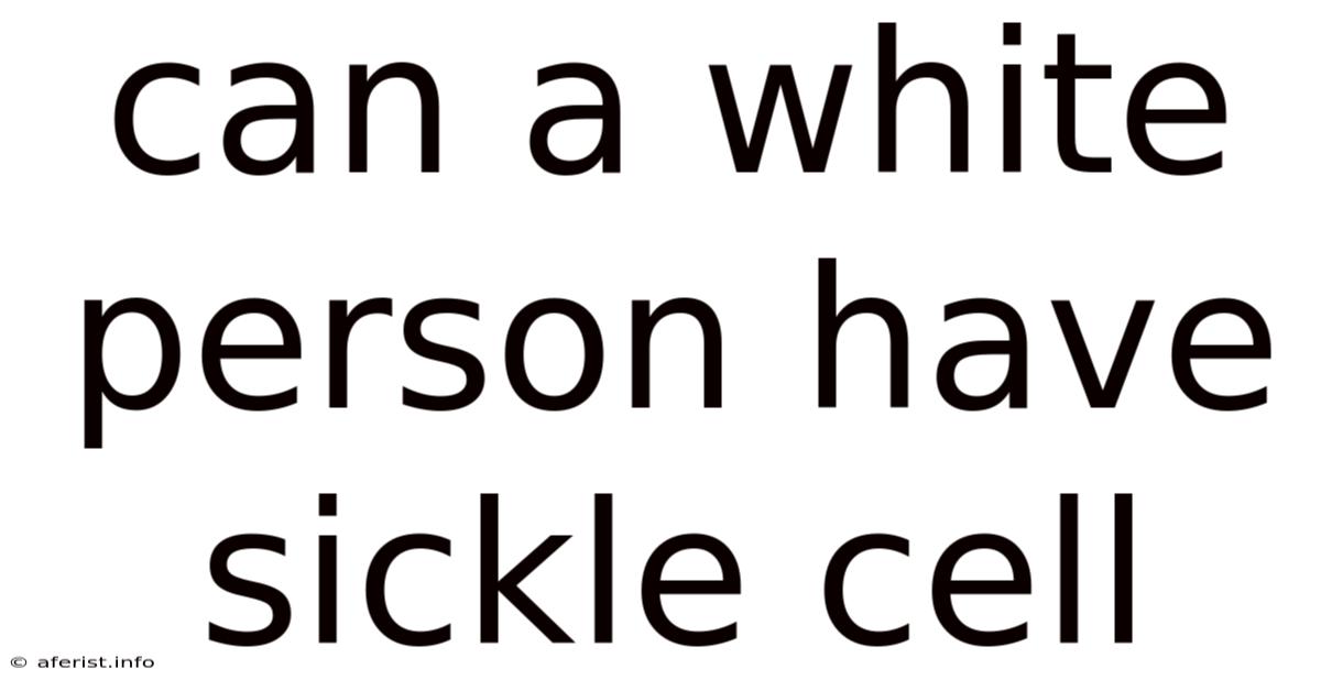Can A White Person Have Sickle Cell
