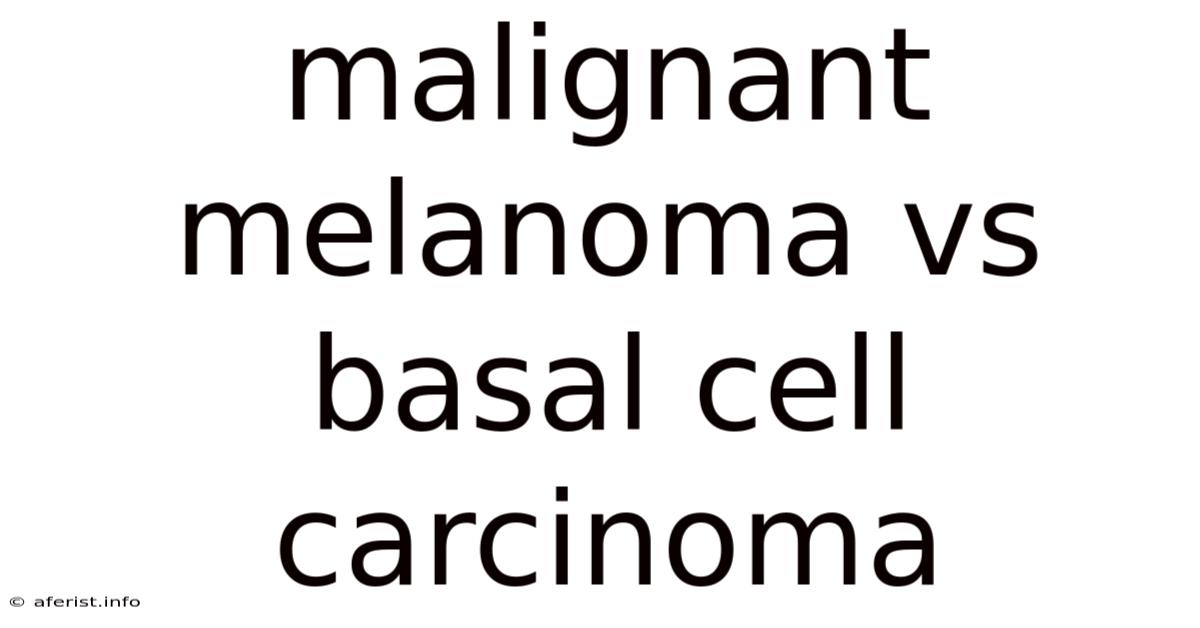 Malignant Melanoma Vs Basal Cell Carcinoma