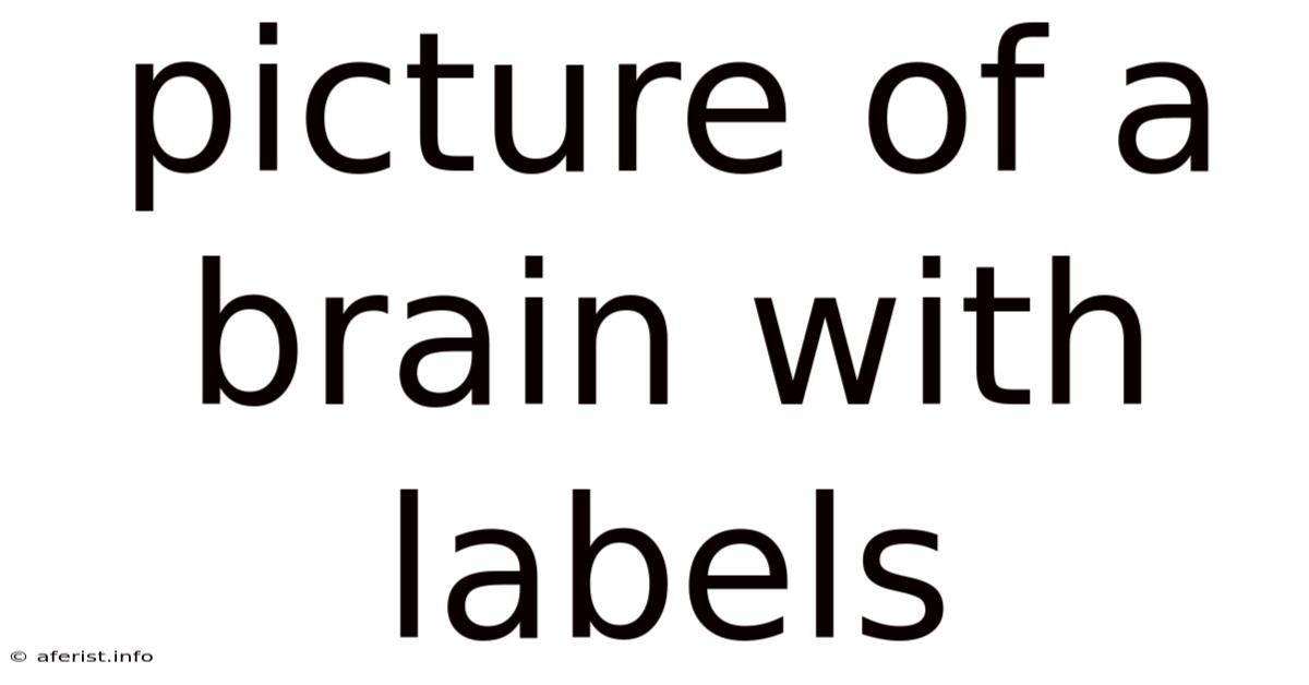Picture Of A Brain With Labels